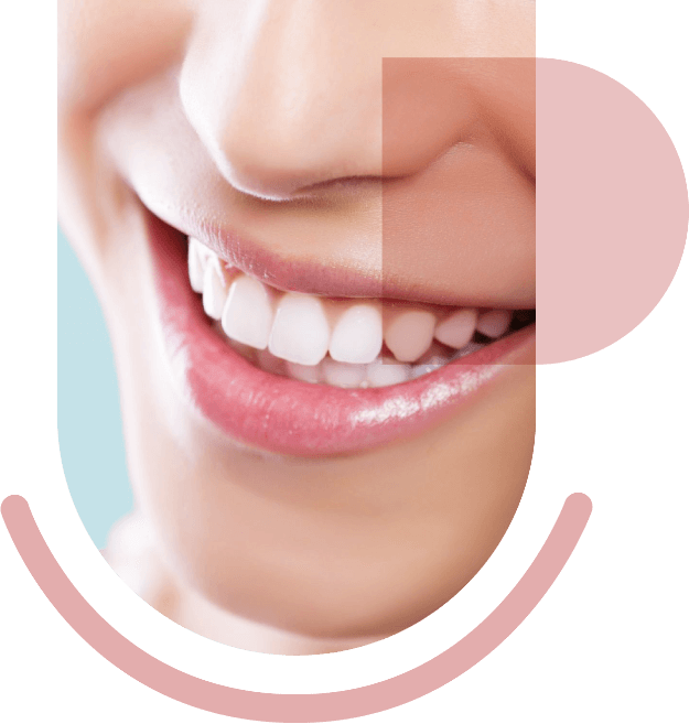Preguntas sobre estética dental en Clínica Dental Real