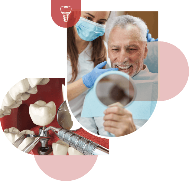 Función de implantes dentales en Clinica Dental Real