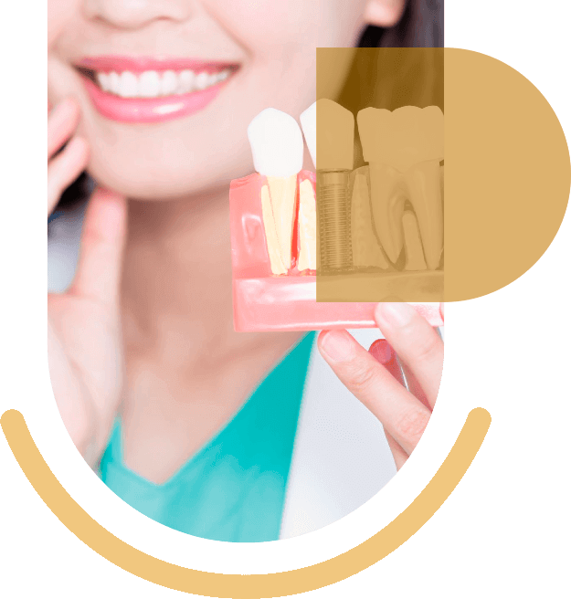 Preguntas sobre implantes dentales en Clínica Dental Real