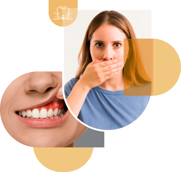 Señales de enfermedades periodontales en Clínica Dental Real